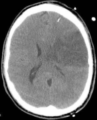 Article Image 1