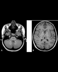 Article Image 1