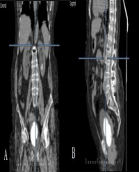 Article Image 1