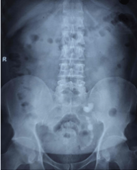 Article Image 1