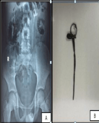 Article Image 1