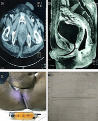 Article Image 1