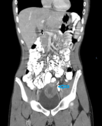 Article Image 1