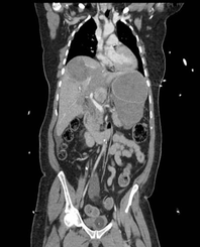 Article Image 1