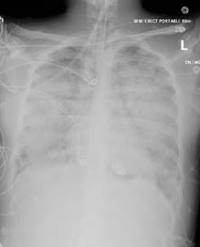 Article Image 1