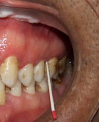 Article Image 1