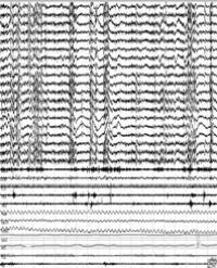 Article Image 1
