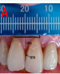 Article Image 1