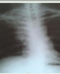 Article Image 1