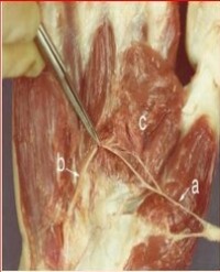 Article Image 1
