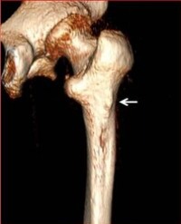 Article Image 1
