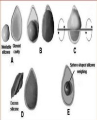 Article Image 1