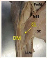 Article Image 1