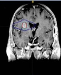 Article Image 1