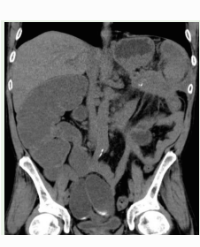 Article Image 1
