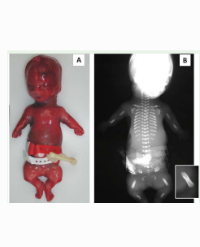 Article Image 1
