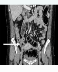 Article Image 1