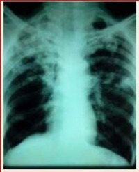Article Image 1