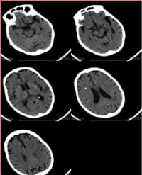 Article Image 1