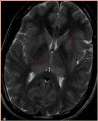Article Image 1