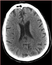 Article Image 1