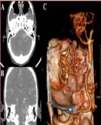 Article Image 1