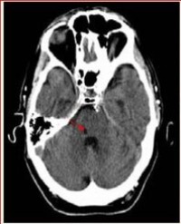Article Image 1