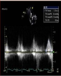 Article Image 1