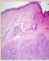 Article Image 1