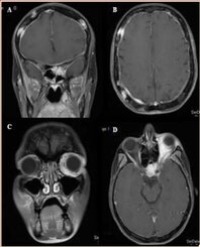 Article Image 1