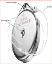 Article Image 1