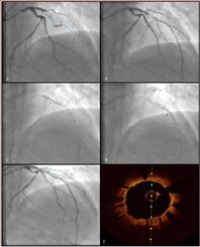 Article Image 1