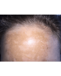 Article Image 1