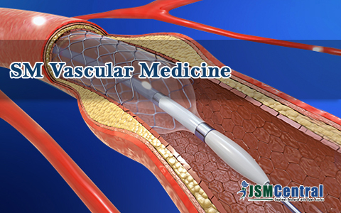 SM Vascular Medicine
